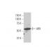 western blotting image from recommended ARX (4A8) monoclonal antibody replacement. Image 352234