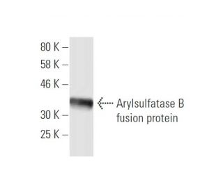 Arylsulfatase B Antibody (2G6) - Western Blotting - Image 348436
