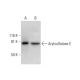Arylsulfatase E Antibody (F-4) - Western Blotting - Image 293042