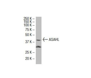 ASAHL Antibody (A19) - Western Blotting - Image 33842Each CRISPR/Cas9 Knockout (KO) Plasmid product consists of a pool of 3 plasmids designed to ensure identification and cleavage of a specific gene for maximum knockout efficiency. Each plasmid encodes a unique 20 nt sequence derived from the GeCKO (v2) library.