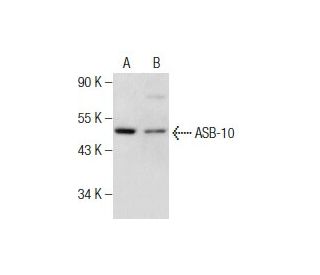 ASB-10 Antibody (QQ6) - Western Blotting - Image 159321 