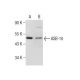 ASB-10 Antibody (QQ6) - Western Blotting - Image 159321 