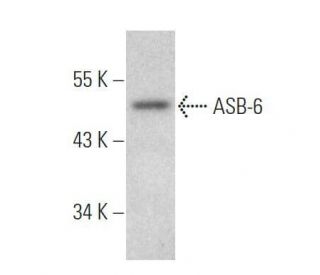 ASB-6 Antibody (H-8) - Western Blotting - Image 356235 
