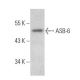 ASB-6 Antibody (H-8) - Western Blotting - Image 356235 