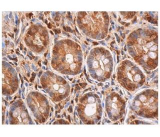 ASC/TMS1/PYCARD Antibody (B-3) - Immunohistochemistry - Image 352923 