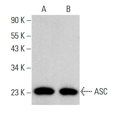 ASC TMS1 PYCARD Anticuerpo B 3 SCBT Santa Cruz