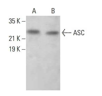 ASC TMS1 PYCARD Anticuerpo B 3 SCBT Santa Cruz