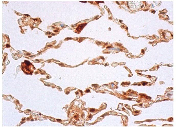 mw様 asc-antibody-f-9-western-