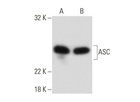 ASC/TMS1/PYCARD Antibody (F-9) | SCBT - Santa Cruz Biotechnology