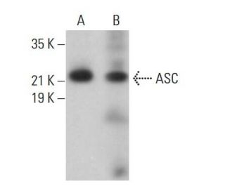 mw様 ASC/TMS1/PYCARD Antibody (F-9) | SCBT - Santa Cruz Biotechnology