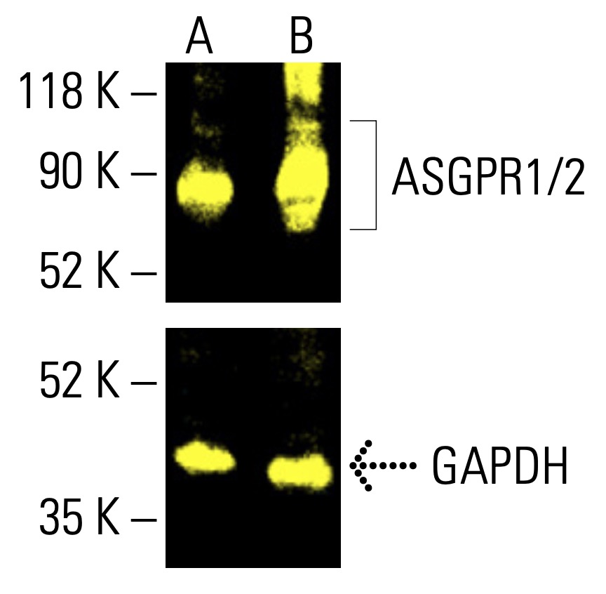 Asialoglycoprotein Receptor 1/2/ASGR1/ASGR2抗体(E-1) | SCBT