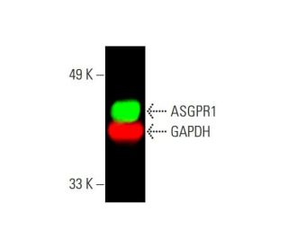 ASGPR1/Asialoglycoprotein Receptor 1/ASGR1 Antibody (8D7) - Western Blotting - Image 387695 