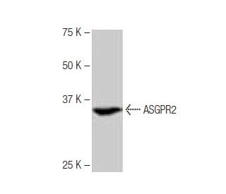 ASGPR2/Asialoglycoprotein Receptor 2/ASGR2 Antibody (3-YD7) - Western Blotting - Image 64861