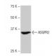 ASGPR2/Asialoglycoprotein Receptor 2/ASGR2 Antibody (3-YD7) - Western Blotting - Image 64861