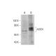 ASIC4 Antibody (E-5) - Western Blotting - Image 325190