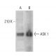 ASK 1 Antibody (E-6) - Western Blotting - Image 381054 