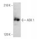 ASK 1 Antibody (H-2) - Western Blotting - Image 353694 