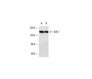 western blotting image from recommended ASK 1 (F-9) monoclonal antibody replacement. Image 1850