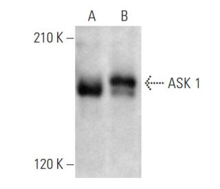 ASK 1 Antibody (E-6) - Western Blotting - Image 353695