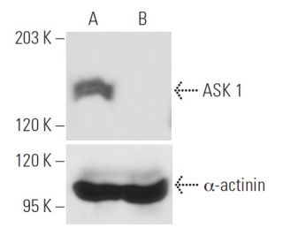 ASK 1 siRNA (h): sc-29748. Western blot analysis of ASK 1 expression in non-transfected control (A) and ASK 1 siRNA transf 
