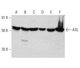 ASL Antibody (B-1) - Western Blotting - Image 384501 