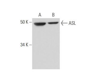 ASL Antibody (E-5) - Western Blotting - Image 291029 