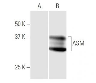 ASM Antibody (4H2) - Western Blotting - Image 347579 
