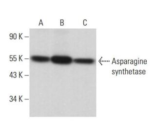 Asparagine synthetase Antibody (F-3) - Western Blotting - Image 381867 
