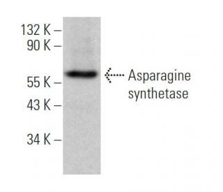 Asparagine synthetase Antibody (G-10) - Western Blotting - Image 373594