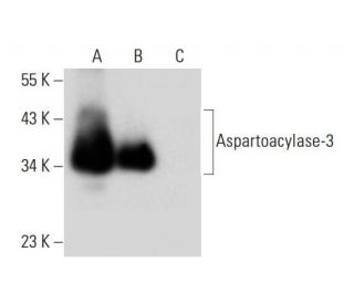 Aspartoacylase-3 Antibody (C-2) - Western Blotting - Image 297952 