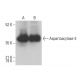 Aspartoacylase-3 Antibody (C-2) - Western Blotting - Image 376447 
