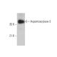 Aspartoacylase-3 Antibody (C-2) - Western Blotting - Image 377444