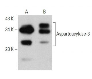 Aspartoacylase-3 Antibody (D-4) - Western Blotting - Image 380397 