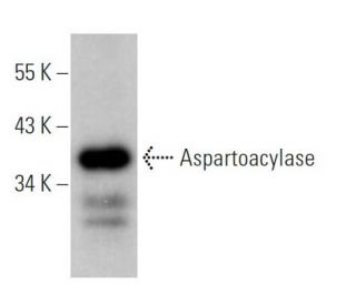 Aspartoacylase Antibody (D-11) - Western Blotting - Image 365986 