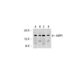 ASPP1 Antibody (LX011) - Western Blotting - Image 14601 