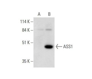 ASS1 Antibody (C-4) - Western Blotting - Image 331162