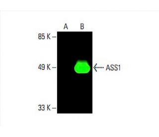 ASS1 Antibody (E-12) - Western Blotting - Image 394219