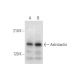 Astrotactin Antibody (H-9) - Western Blotting - Image 319614 