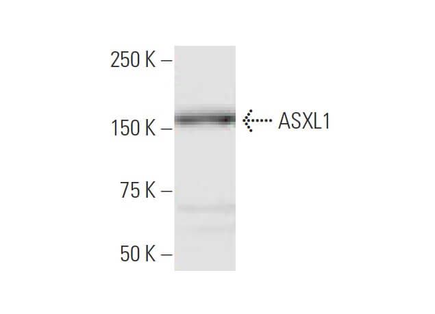 ASXL1抗体(6E2) | SCBT - Santa Cruz Biotechnology