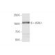 ASXL1 Antibody (6E2) - Western Blotting - Image 347640 