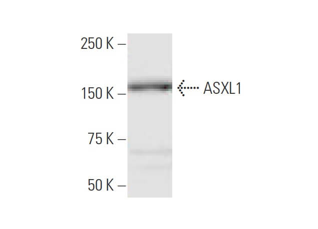 その他 6 asxl1-antibody-6e2-western-