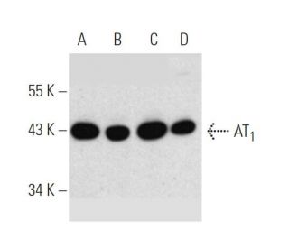 western blotting image from recommended Angiotensin Receptor/AT1/AGTR1 (G-3) monoclonal antibody replacement. Image 371031