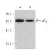 Angiotensin Receptor/AT1/AGTR1 Antibody (G-3) - Western Blotting - Image 380696 