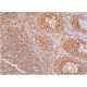 ATAD3B Antibody (A-8) - Immunohistochemistry - Image 385996 