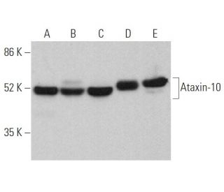 Ataxin-10 Antibody (C-3) - Western Blotting - Image 370102 
