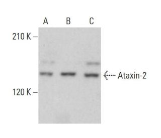 Ataxin-2 Antibody (A-6) - Western Blotting - Image 379151Each CRISPR/Cas9 Knockout (KO) Plasmid product consists of a pool of 3 plasmids designed to ensure identification and cleavage of a specific gene for maximum knockout efficiency. Each plasmid encodes a unique 20 nt sequence derived from the GeCKO (v2) library.