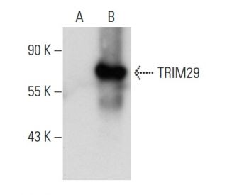 TRIM29 Antibody (A-5) - Western Blotting - Image 93686 