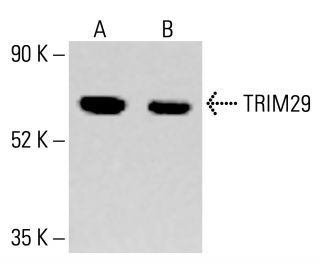 TRIM29 Antibody (B-2) - Western Blotting - Image 413777 