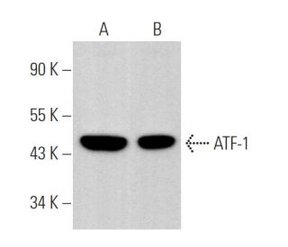 ATF-1/ATF1 Antibody (ATF1 2A9/8) - Western Blotting - Image 374012 