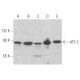 western blotting image from recommended ATF-2 (F2BR-1) monoclonal antibody replacement. Image 354156